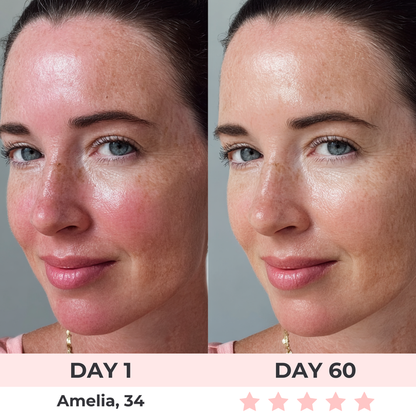 VisageFlow™ - LED Face Mask